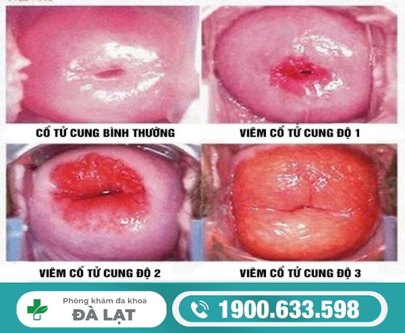 Hình ảnh minh họa